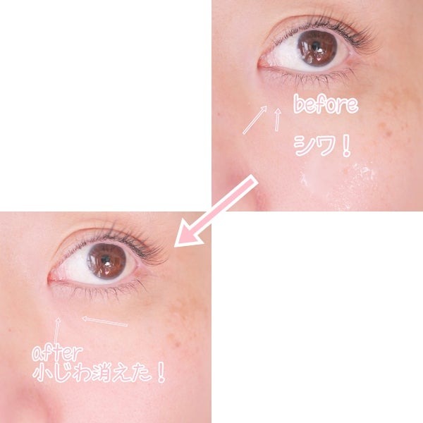 バクチオールスーパーバイオーム リフティングアンプル/VELY VELY/美容液を使ったクチコミ(6枚目)