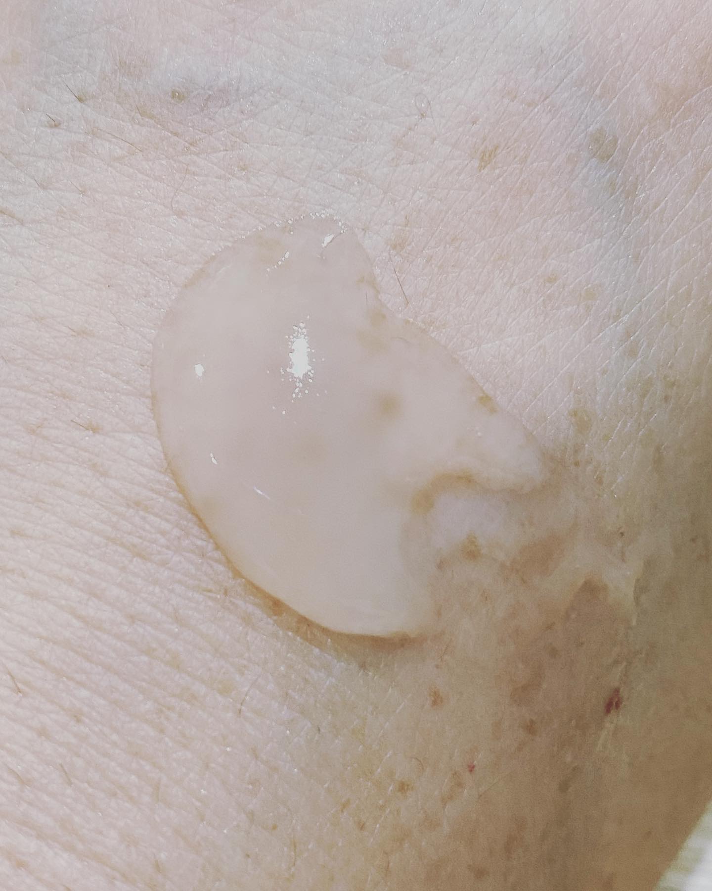 スペシャルジェルクリームN （モイスト）/アクアレーベル/オールインワン化粧品を使ったクチコミ（3枚目）