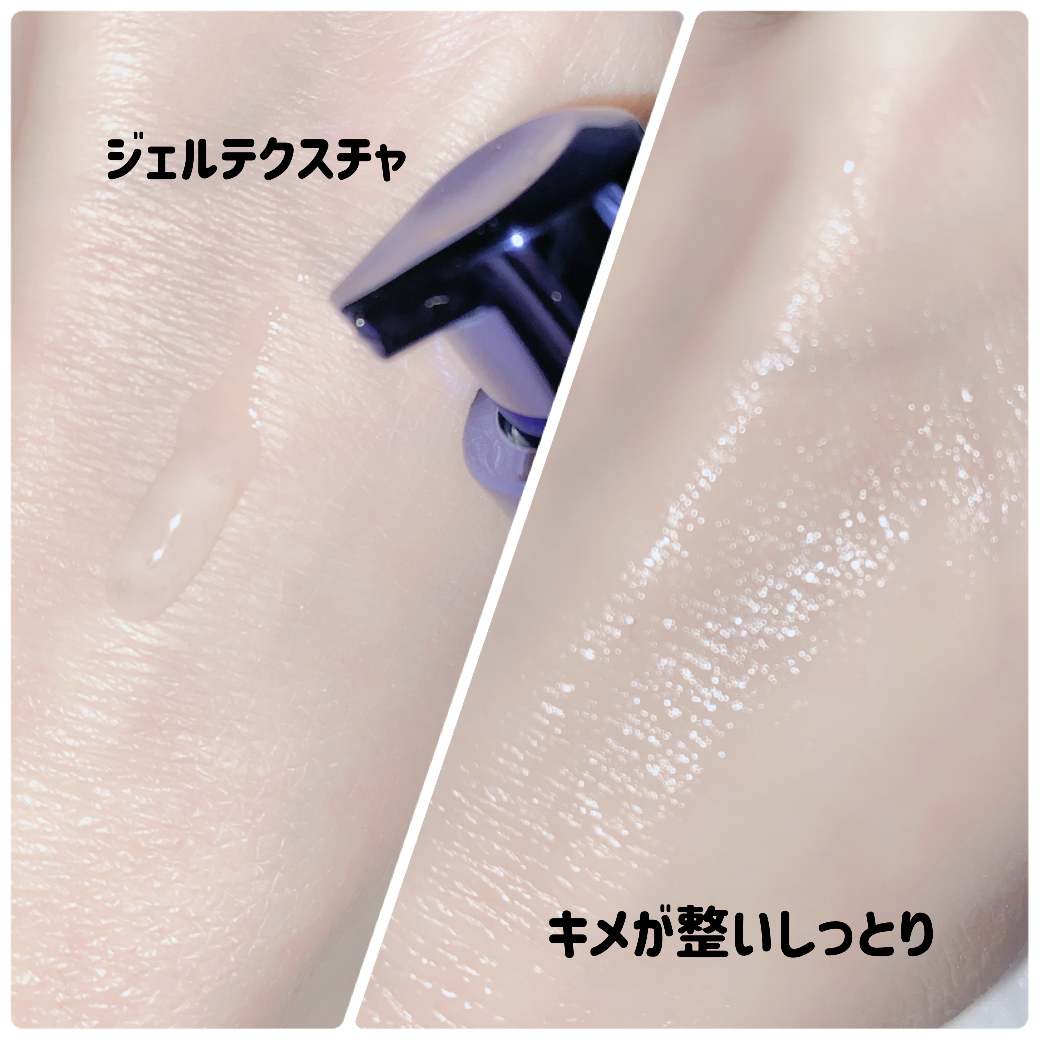 フィトPDRNカプセルショットアンプル2000/One-day's you/美容液を使ったクチコミ（3枚目）