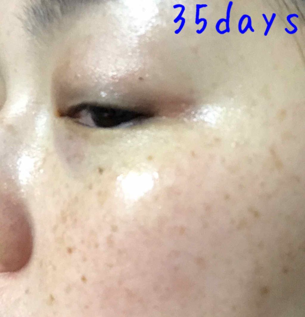 エマルジョン II/BENEFIQUE/乳液を使ったクチコミ(1枚目)