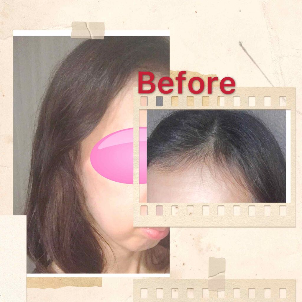 泡カラー 白髪用/ブローネ/ヘアカラーを使ったクチコミ(1枚目)