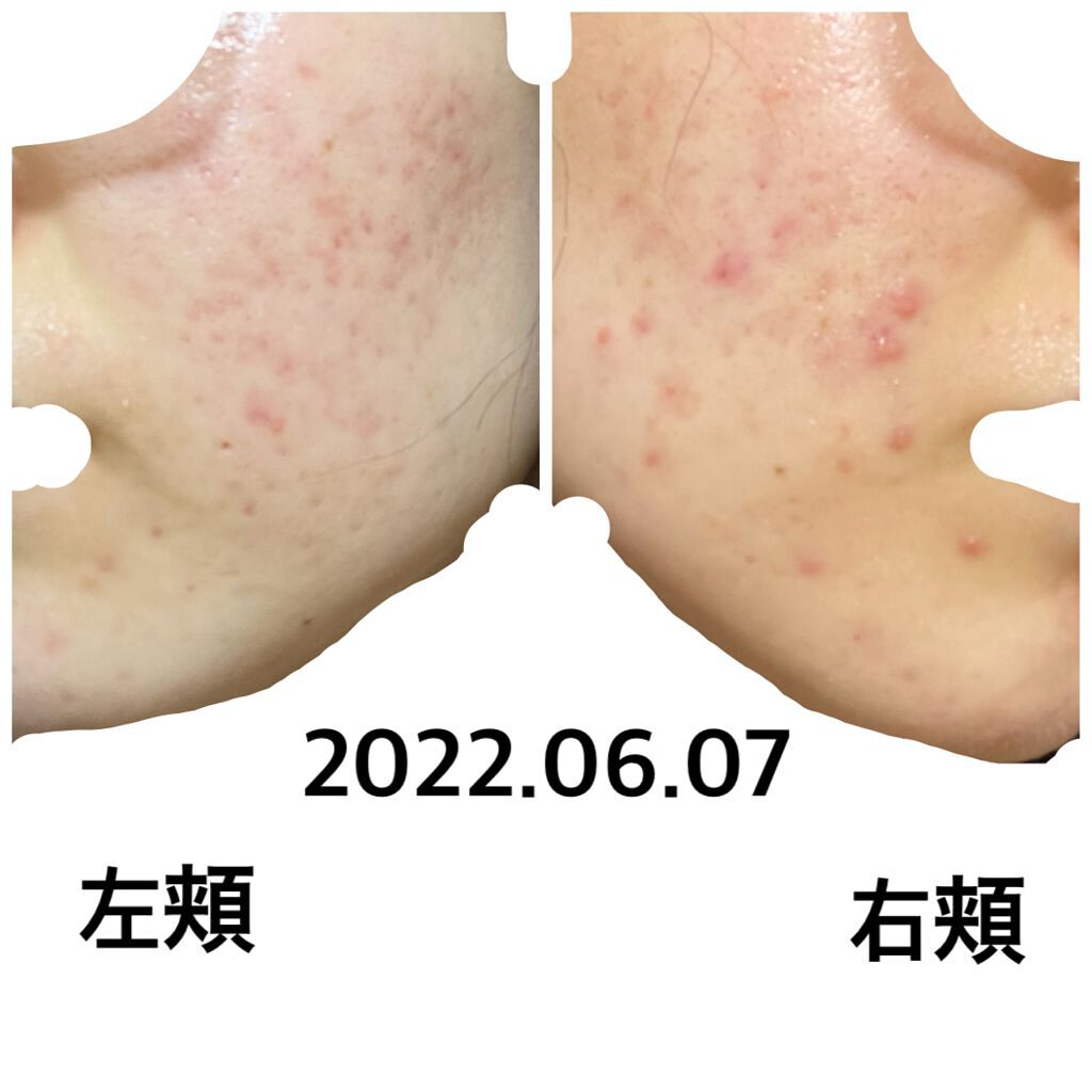 スムースクレンジングバーム/PERFECT ONE  FOCUS/クレンジングバームを使ったクチコミ（1枚目）