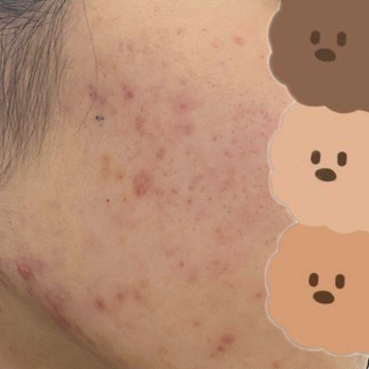 colza on LIPS 「-肌日記230227-2月中旬ぐらいから食欲が一気になくなって..」(4枚目)