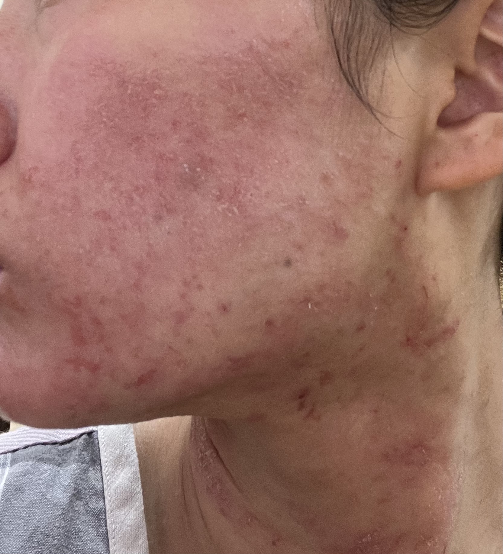 無印良品のスキンケア・基礎化粧品 敏感肌用化粧水 高保湿＆敏感