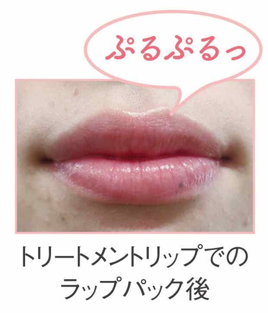 トリートメントリップ/ドクターリセラ/リップケアを使ったクチコミ(3枚目)