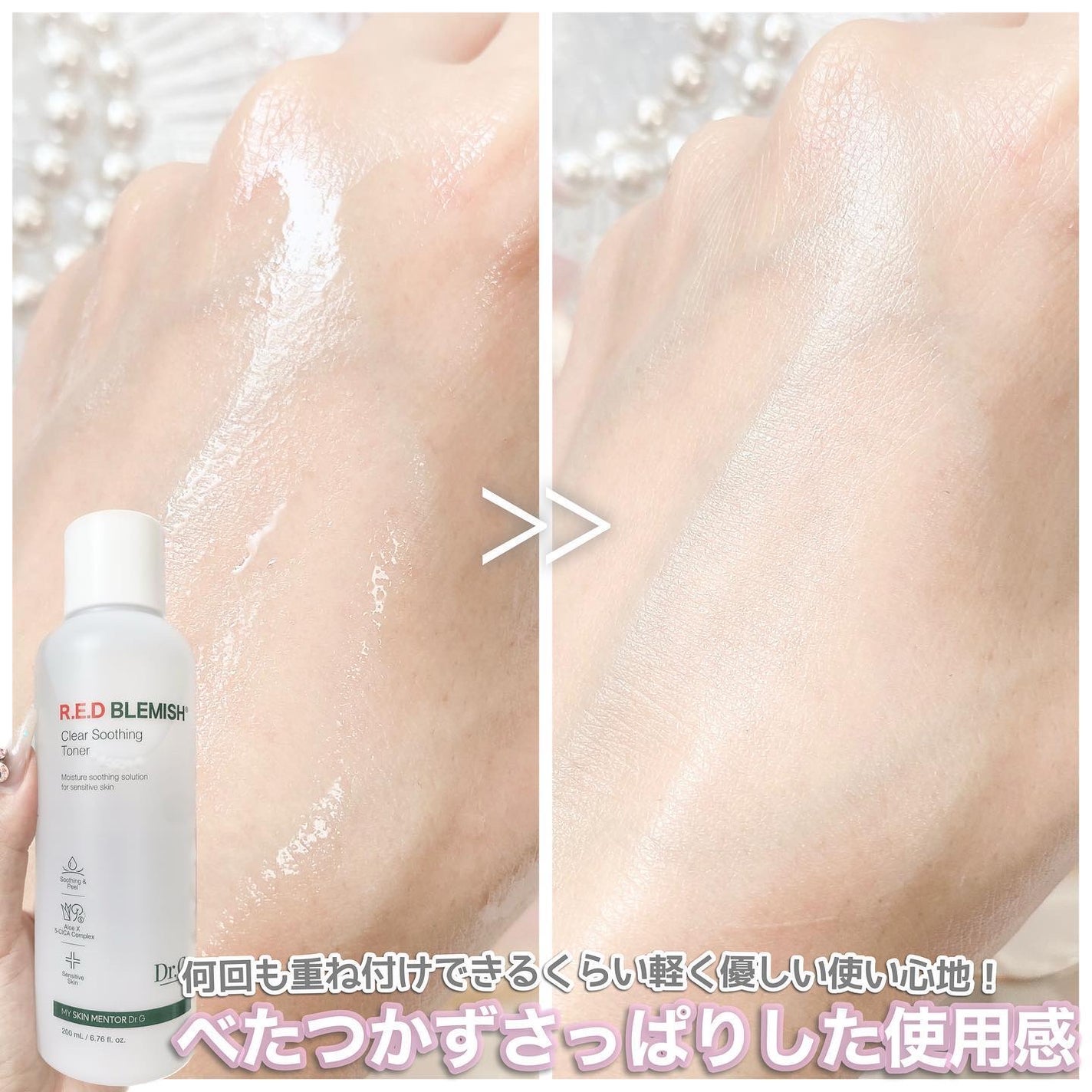 レッドブレミッシュ クリアスージングトナー/Dr.G/化粧水を使ったクチコミ(4枚目)