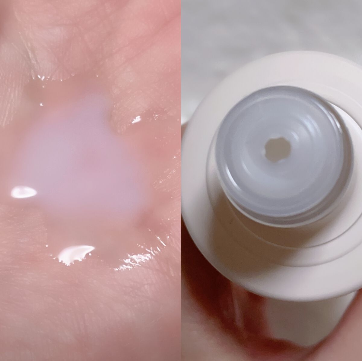 CERAPYome Moist In Treatment/my skin solus/美容液を使ったクチコミ(2枚目)