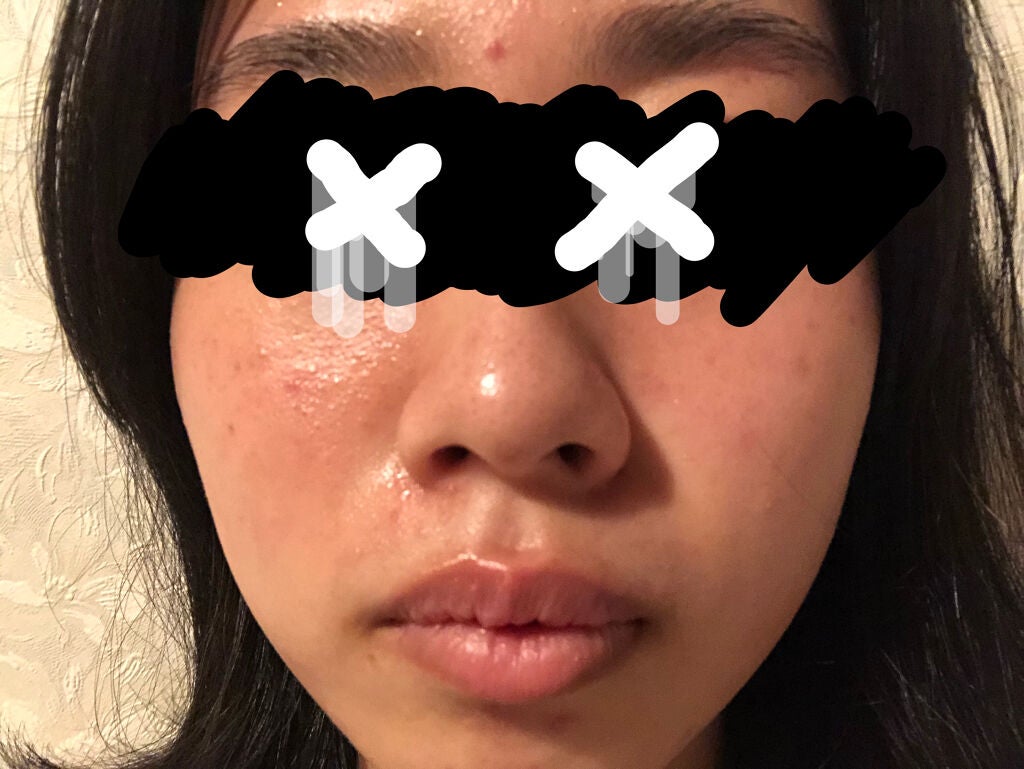 艶肌ドロップ/ラッシュ/美容液を使ったクチコミ(3枚目)