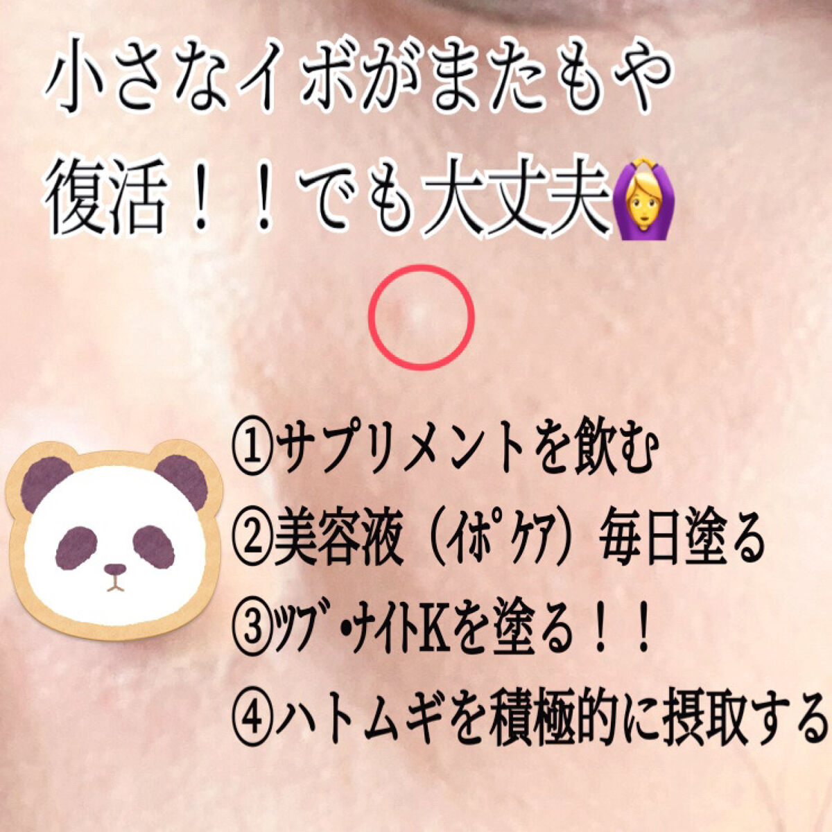 DHC はとむぎエキス/DHC/健康サプリメントを使ったクチコミ（1枚目）