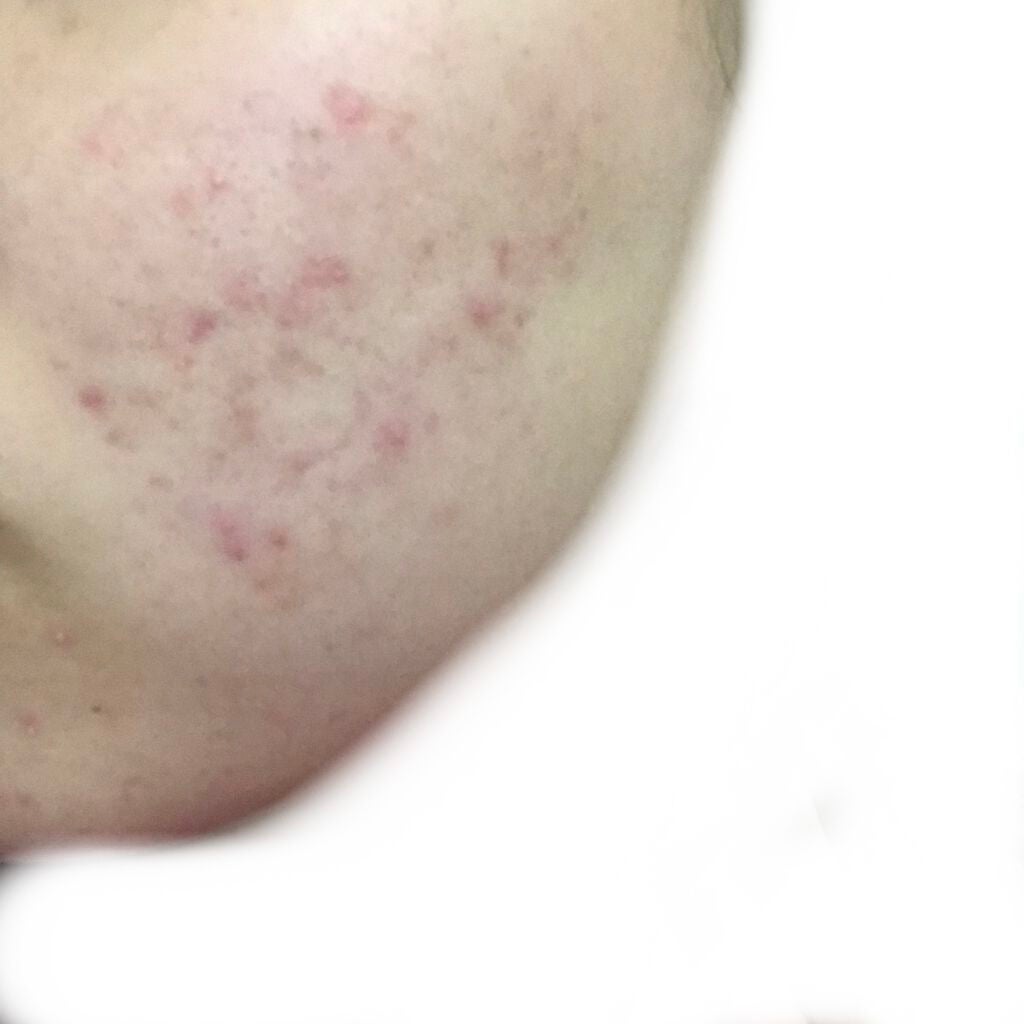 デュオ ザ クレンジングバーム クリア/DUO/クレンジングバームを使ったクチコミ(3枚目)