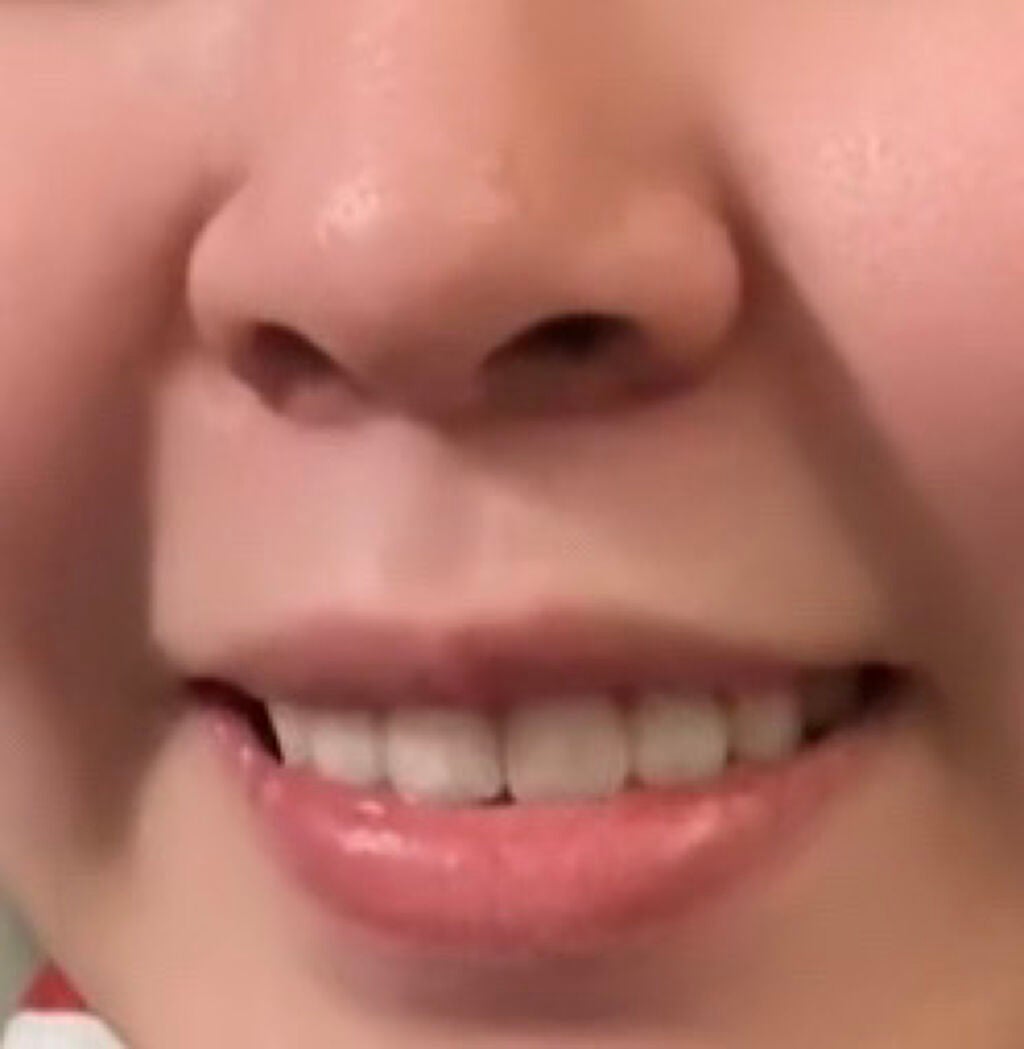 清潔感Quest on LIPS 「鼻先から口元にかけてかなり不恰好なんですけど、何が一目で見て目..」(1枚目)