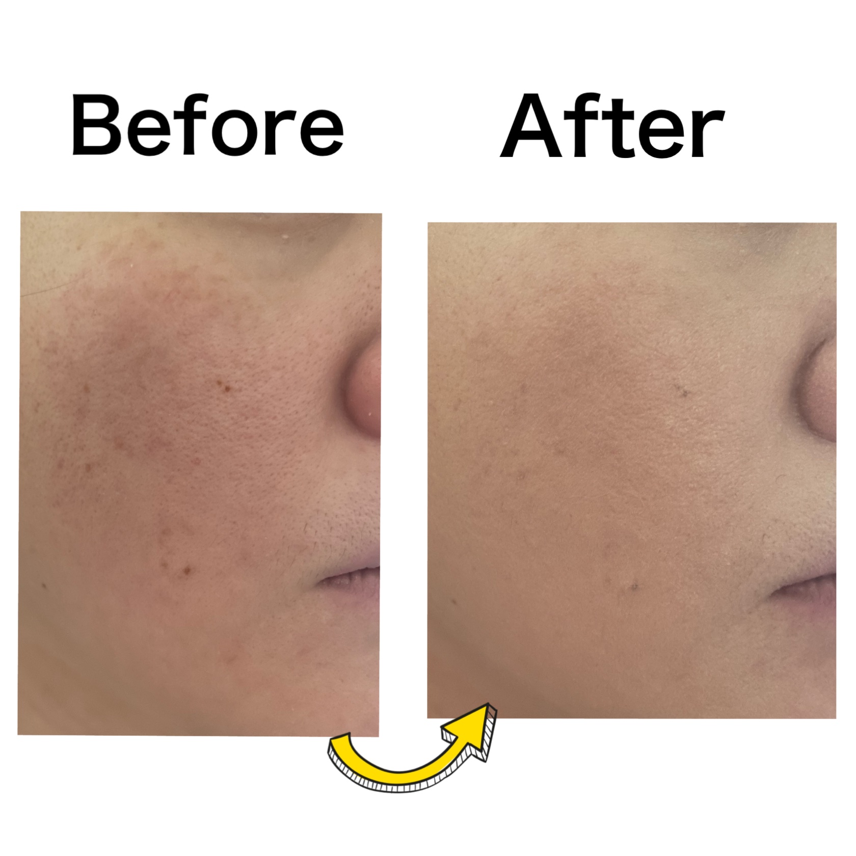 MISSHA ミシャ グロウ レイヤリングフィットクッションのクチコミ「＼しっとり伸びる！／
星5評価で表すと

カバー力　　★★★★☆
崩れにくさ　★★★★★
コス.....」（3枚目）