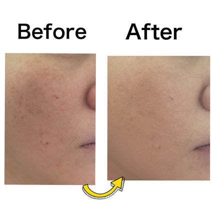 ミシャ グロウ レイヤリングフィットクッション/MISSHA/クッションファンデーションを使ったクチコミ(3枚目)