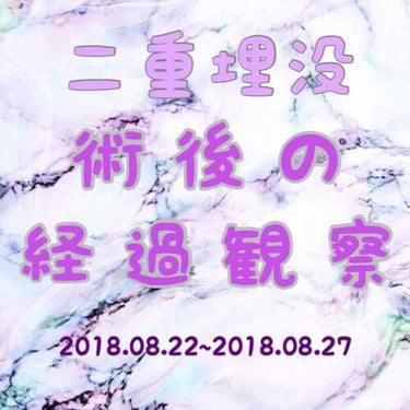 れとま on LIPS 「手術直後から本日までの目の様子です！手術から2時間後には仕事を..」（1枚目）