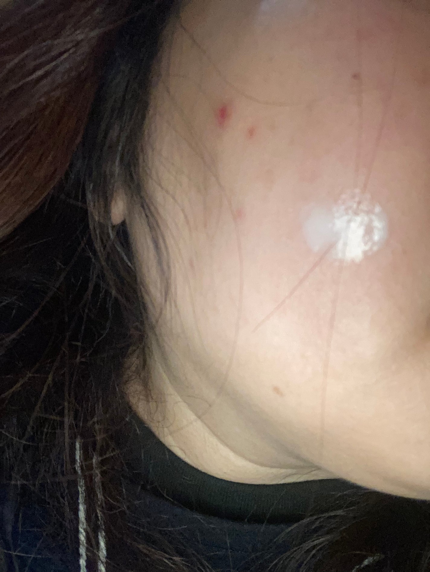 リードルショット1000/VT/ブースター・導入液を使ったクチコミ(2枚目)