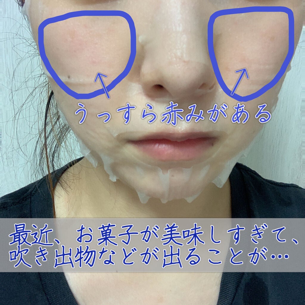 マイリアル スクイーズ マスクシート/innisfree/シートマスク・パックを使ったクチコミ(2枚目)