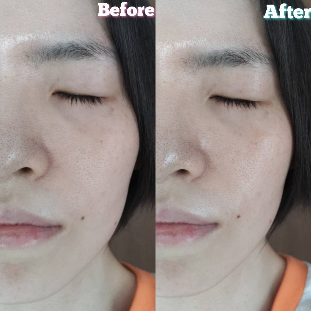 ゼロ毛穴パッド 2.0/MEDICUBE/トナーパッドを使ったクチコミ(5枚目)