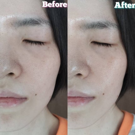 ゼロ毛穴パッド 2.0/MEDICUBE/トナーパッドを使ったクチコミ(5枚目)