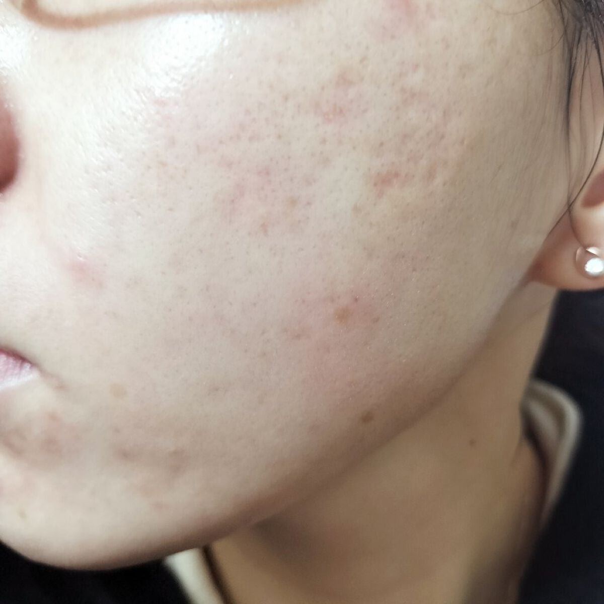 miina@汚肌工事録⚠️ on LIPS 「✍12/4の#汚肌工事録Thanksforyourbrosin..」(2枚目)