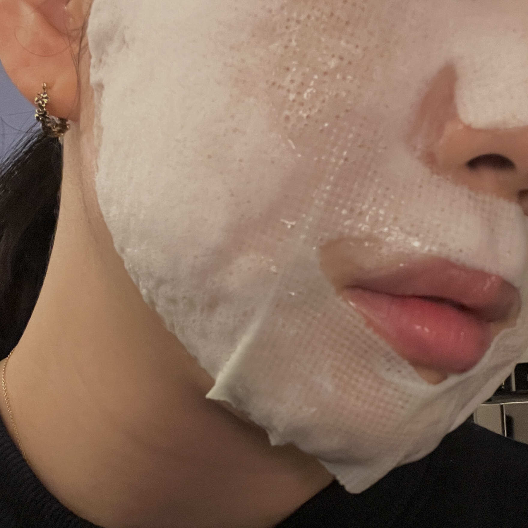 スージング バブル トックス/MEDIHEAL/その他スキンケアを使ったクチコミ（3枚目）