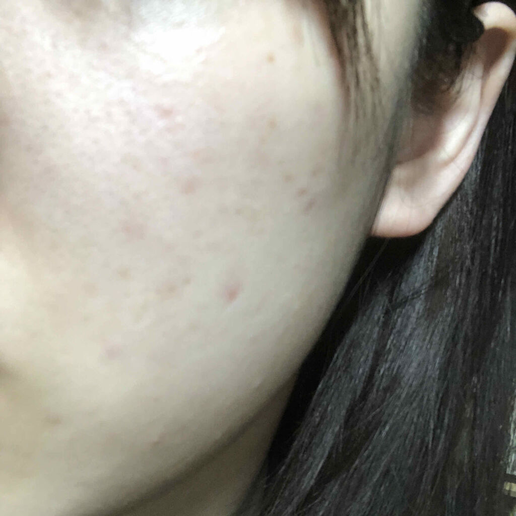 泡洗顔料 しっとりタイプ/オードムーゲ/泡洗顔を使ったクチコミ（2枚目）