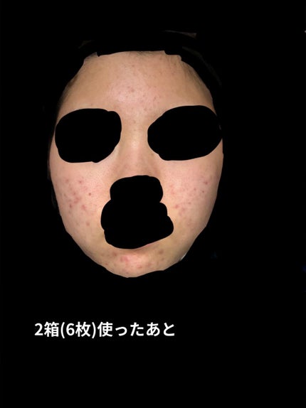 ティーツリーケアソリューション アンプルマスクJEX/MEDIHEAL/シートマスク・パックを使ったクチコミ(4枚目)