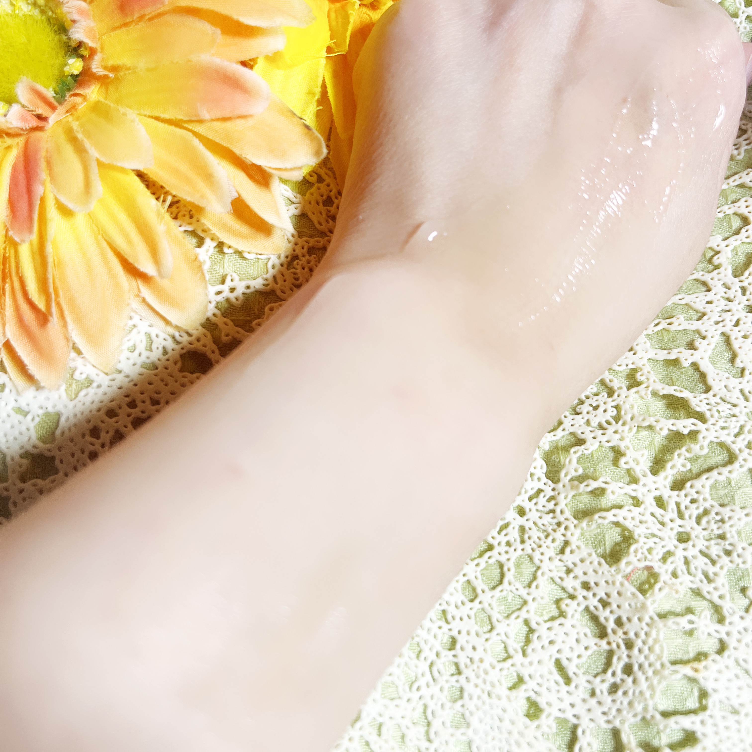 タカミスキンピールボディ/タカミ/ボディローションを使ったクチコミ（3枚目）