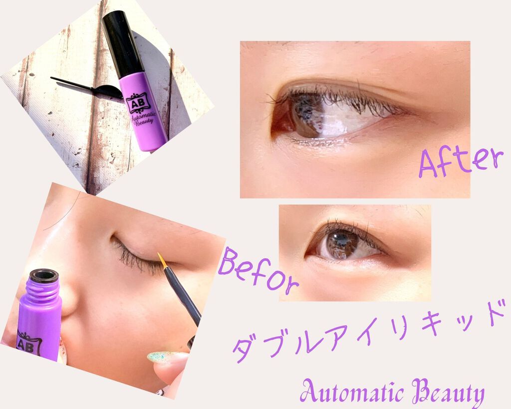 試してみた】メジカルファイバー Automatic Beautyのリアルな口コミ