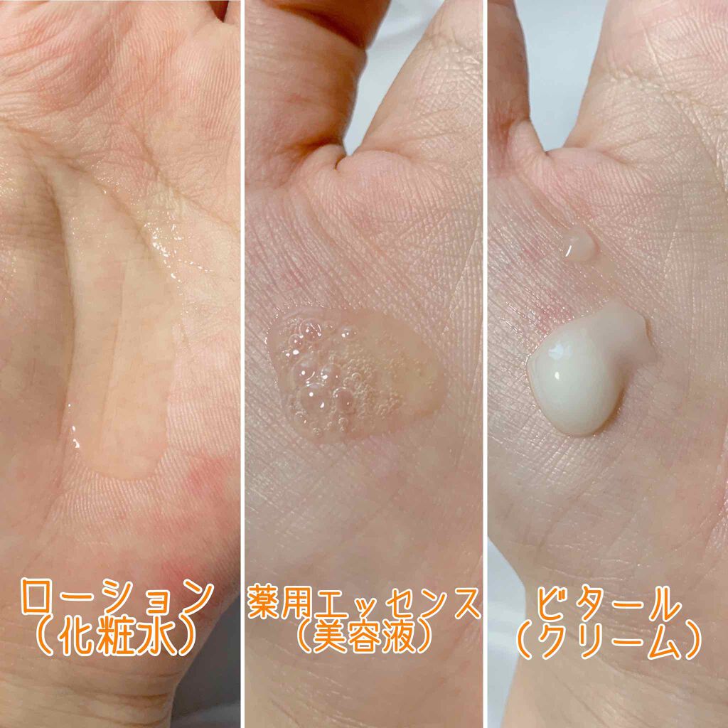 VCスターターセット/VCシリーズ/スキンケアキットを使ったクチコミ(2枚目)