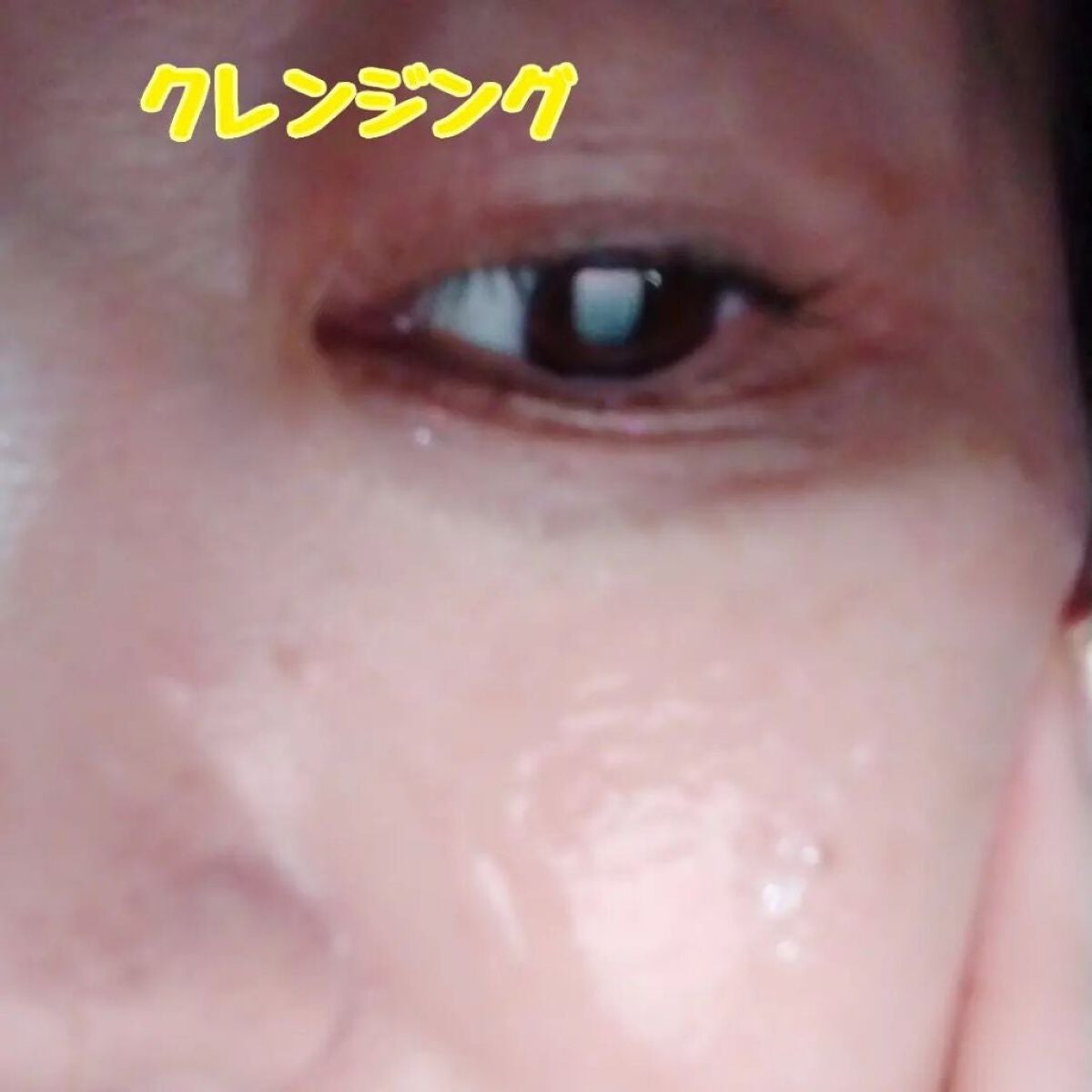 薬用 RJエッセンス/アピセラピーコスメティクス/美容液を使ったクチコミ(5枚目)