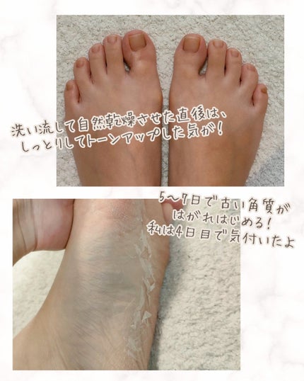 あしやすめ 足裏角質ケアパック/鎌倉ライフ/レッグ・フットケアを使ったクチコミ(3枚目)