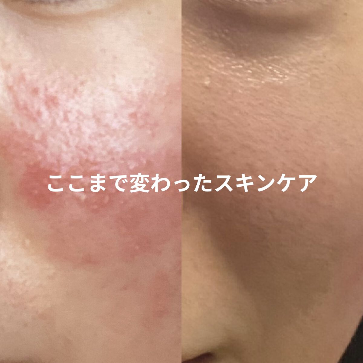 セラヴェール スキンウォッシューインデュースー/CeraLabo/その他洗顔料を使ったクチコミ（1枚目）