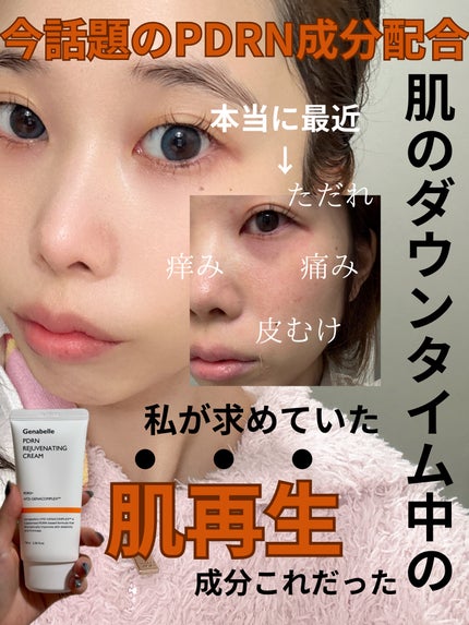 PDRNリジュビネイティングクリーム/Genabelle/フェイスクリームを使ったクチコミ(1枚目)