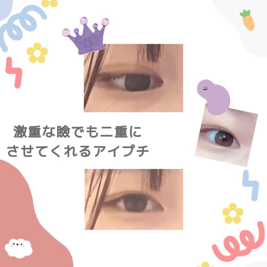 のびーるアイテープ(絆創膏タイプ、レギュラー)/DAISO/二重まぶた用アイテムを使ったクチコミ(1枚目)