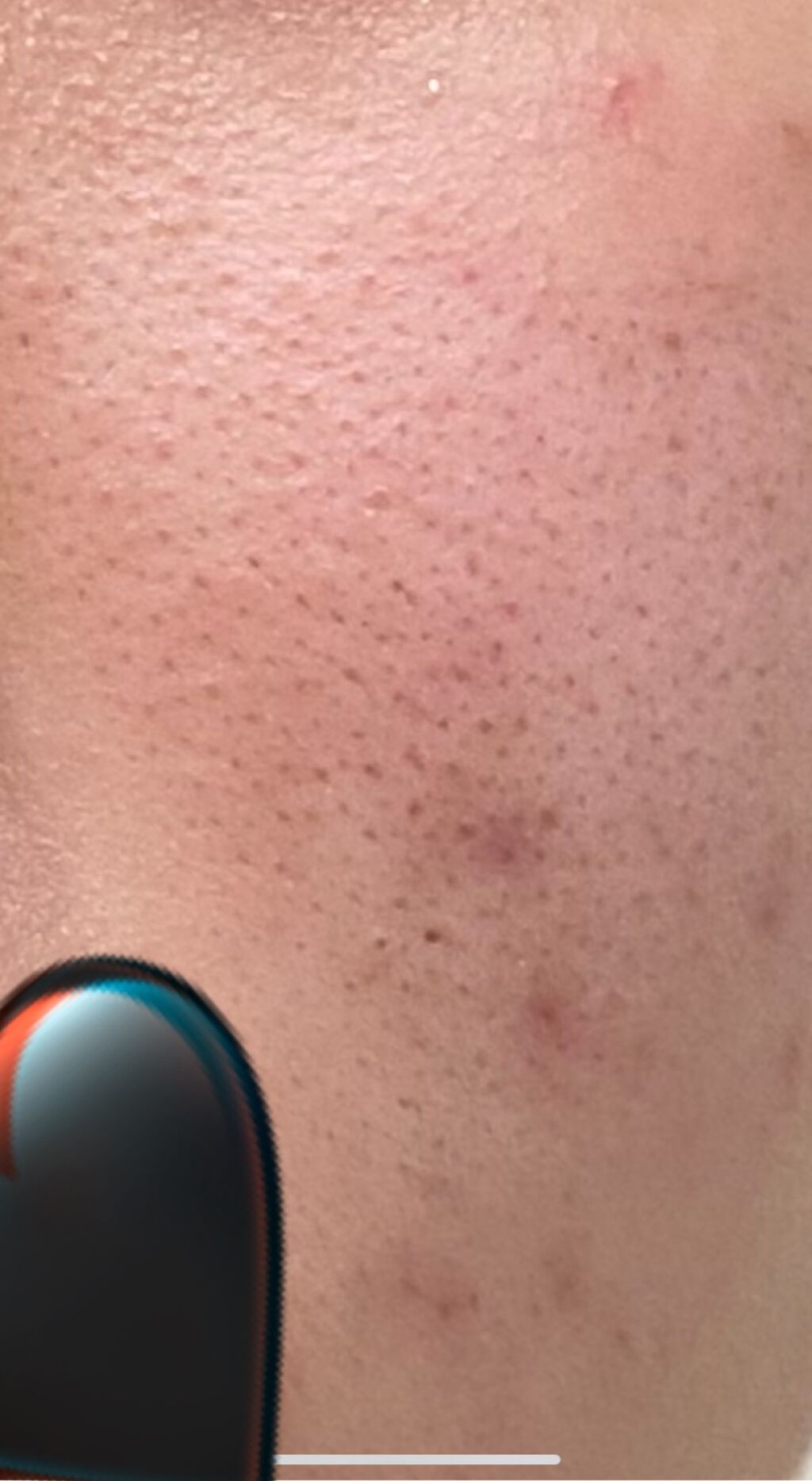 お米のマスク/毛穴撫子/シートマスク・パックを使ったクチコミ（2枚目）