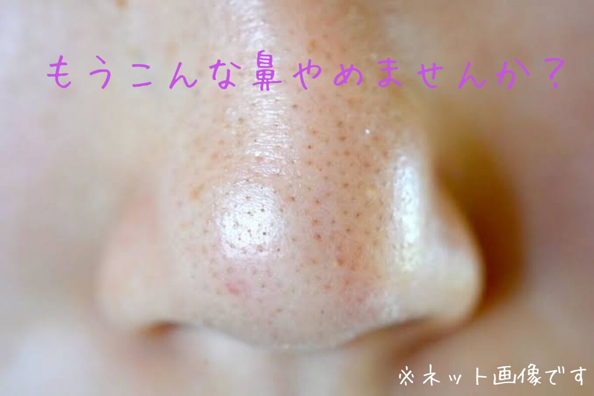 パナ on LIPS 「いちご鼻から解放されましょ!!お久しぶりですm(*__)mパナ..」(1枚目)