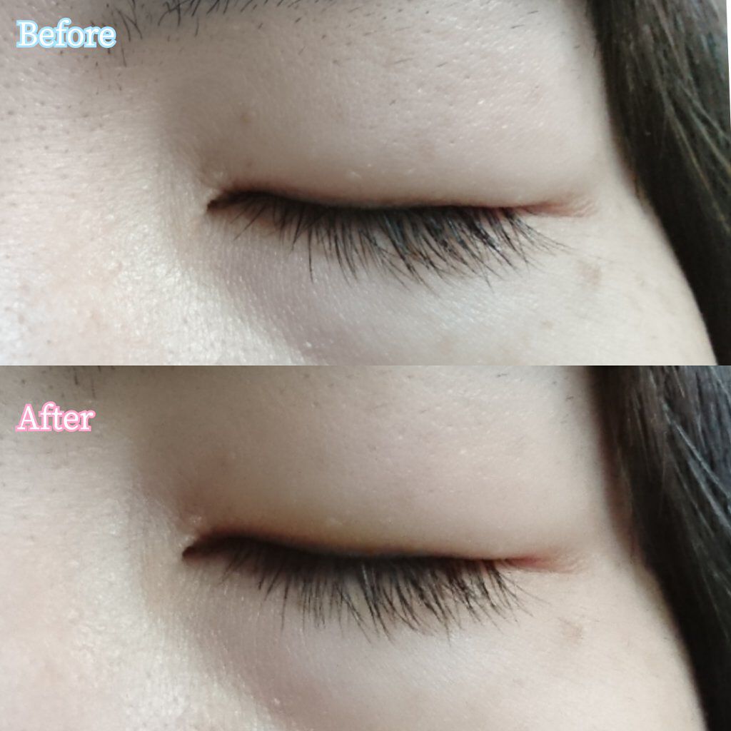 金のプラセンタもっちり白肌濃シワトール/ホワイトラベル/アイケア・アイクリームを使ったクチコミ(4枚目)