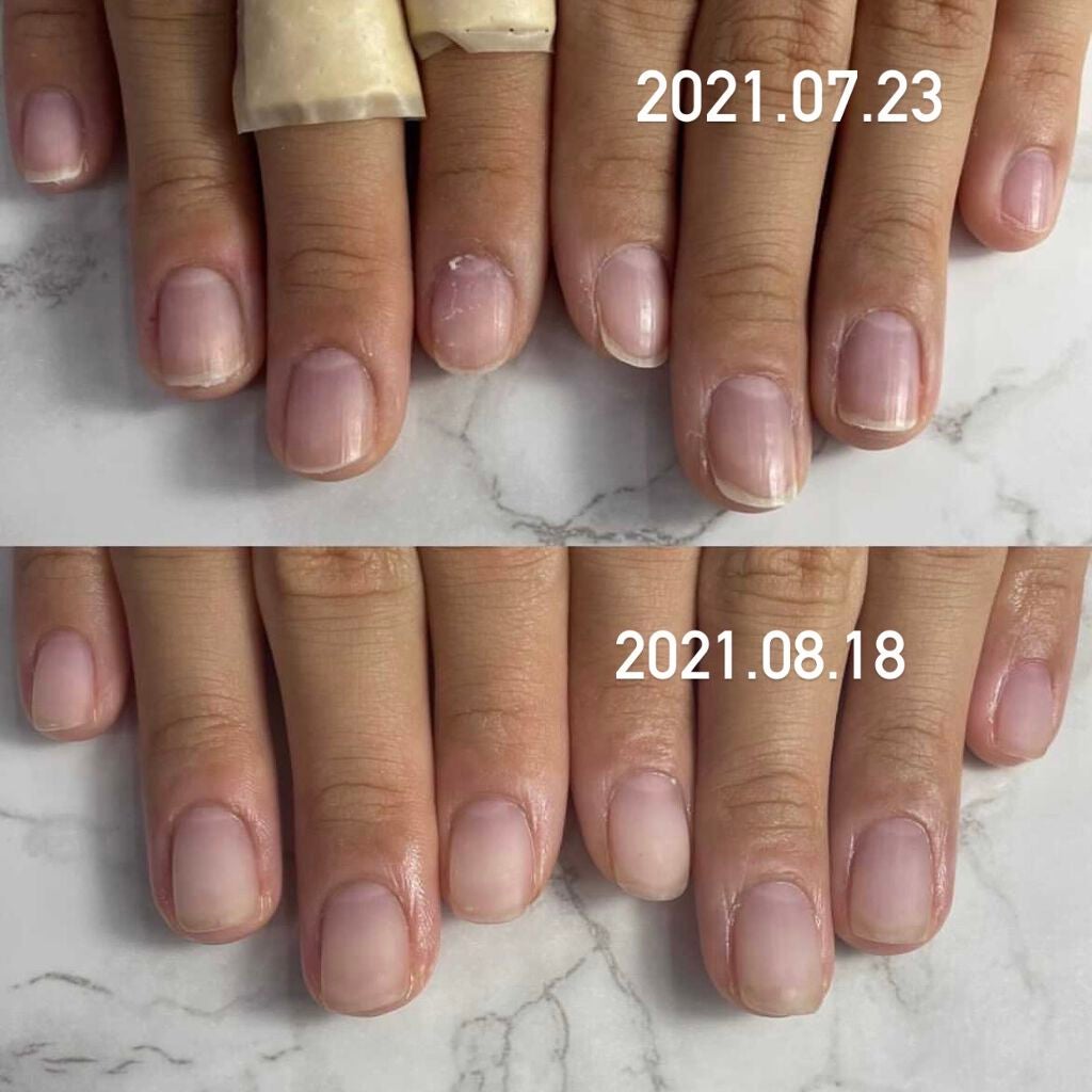 ナイトリニューハンドクリーム/コエンリッチQ10/ハンドクリームを使ったクチコミ(5枚目)