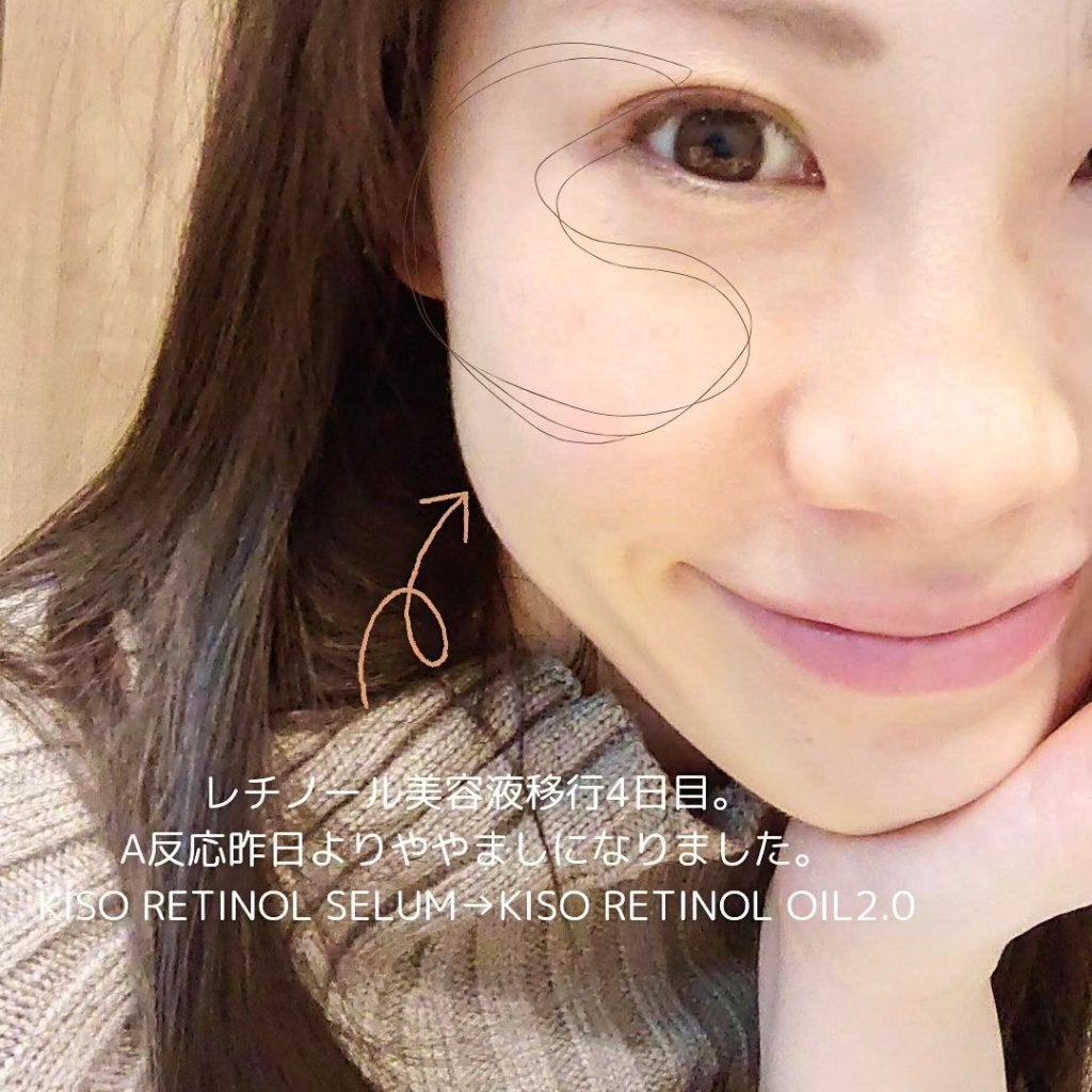 シミ・ソバカス予防ケア フェイスクリーム/キュレル/フェイスクリームを使ったクチコミ(2枚目)