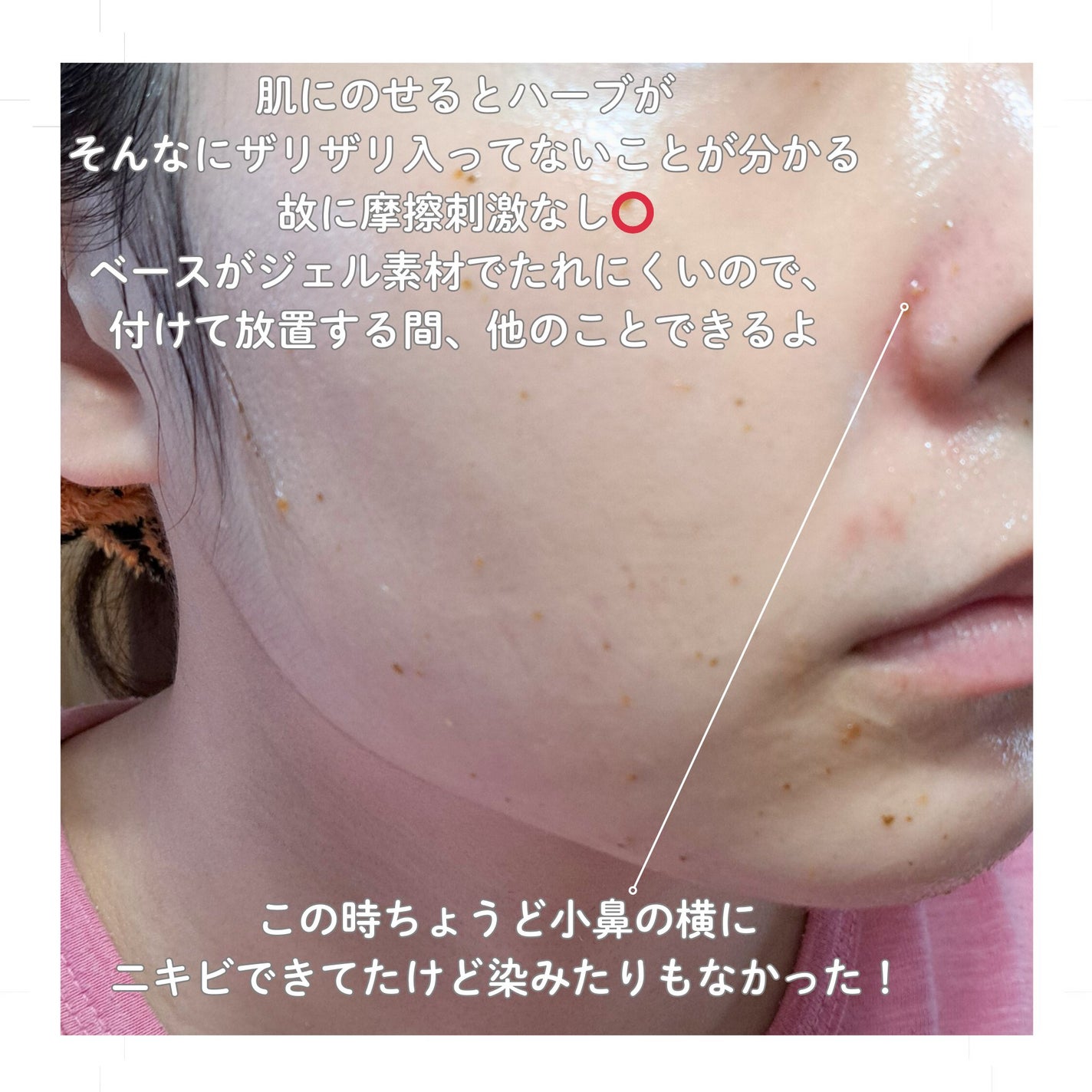 リアルシカペストパック/ビューランチ/洗い流すパック・マスクを使ったクチコミ(3枚目)