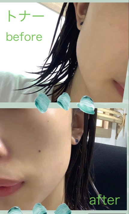 <楽天限定>ドクダミ3種セット/Abib /スキンケアキットを使ったクチコミ(4枚目)