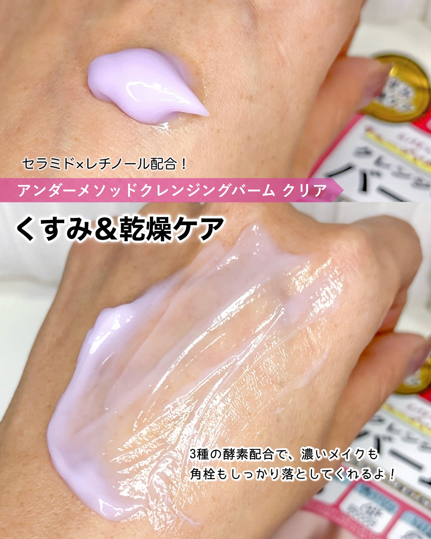 クレンジングバーム ブラック/アンダーメソッド/クレンジングバームを使ったクチコミ(4枚目)