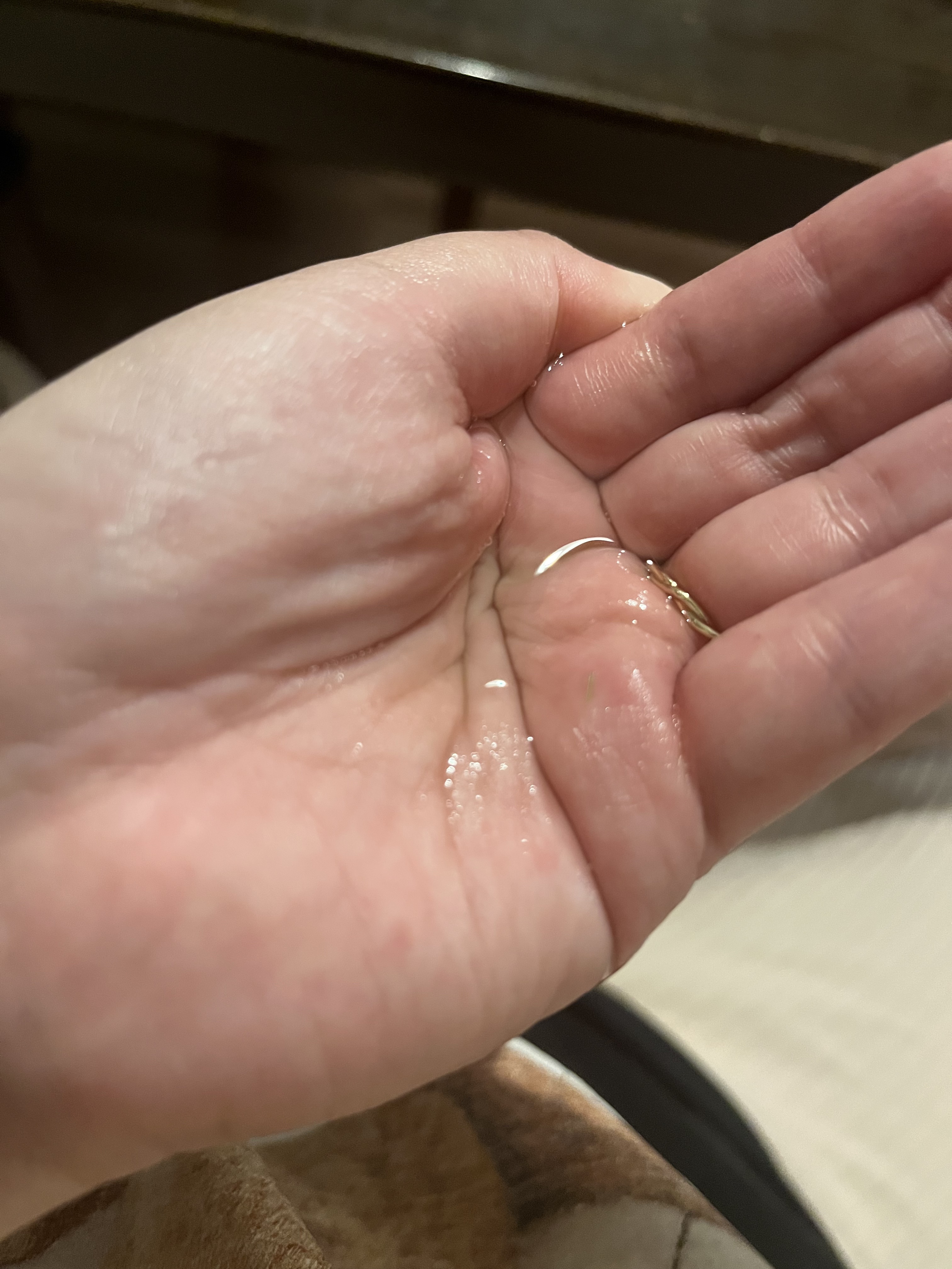 センテラ ライトクレンジングオイル/SKIN1004/オイルクレンジングを使ったクチコミ（2枚目）