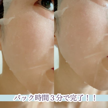 ダーマレーザー スーパーTEATREE100マスク/クオリティファースト/シートマスク・パックを使ったクチコミ(8枚目)