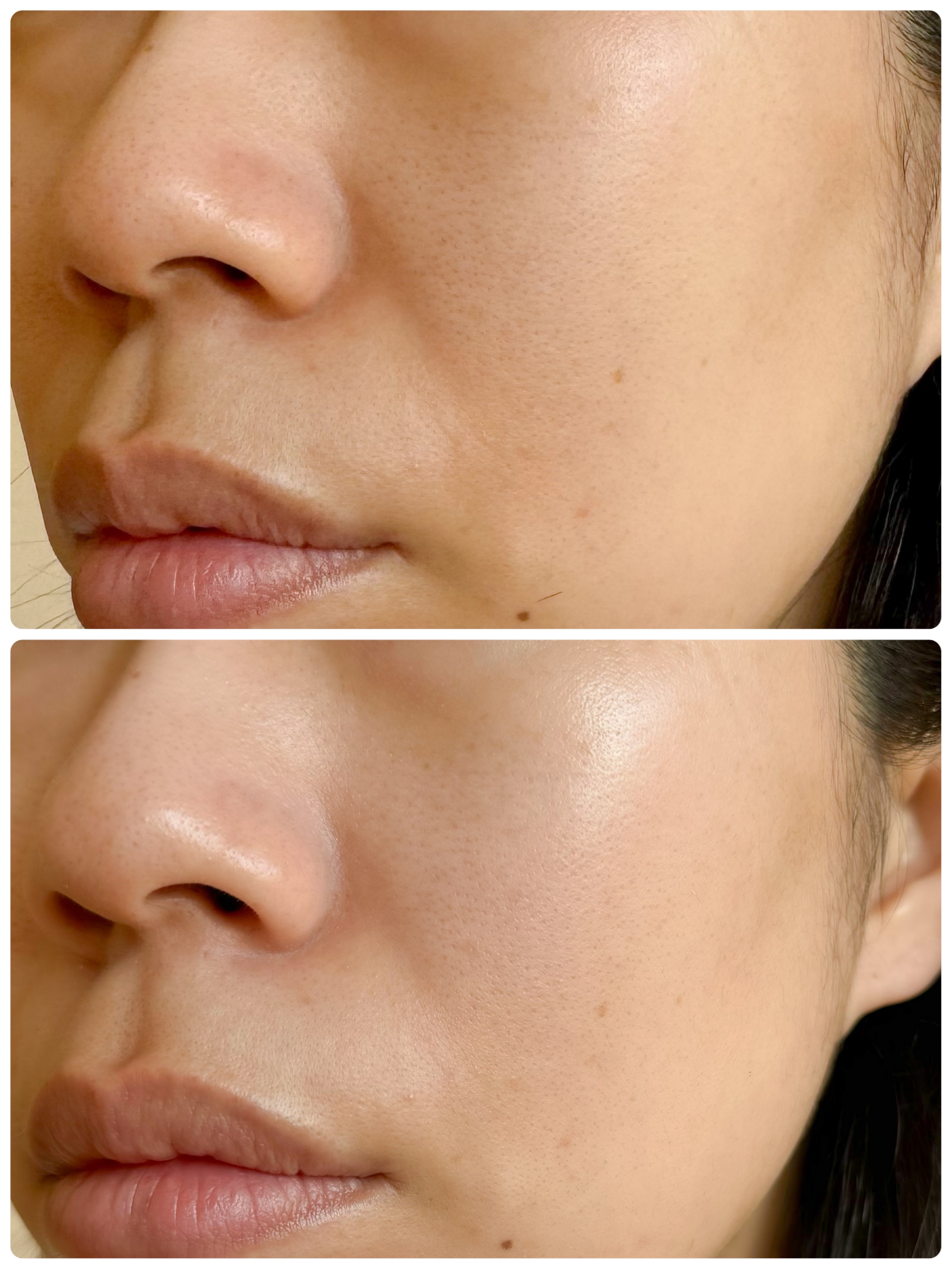 グロウ サン クッション/mgb skin/クッションファンデーションを使ったクチコミ（3枚目）