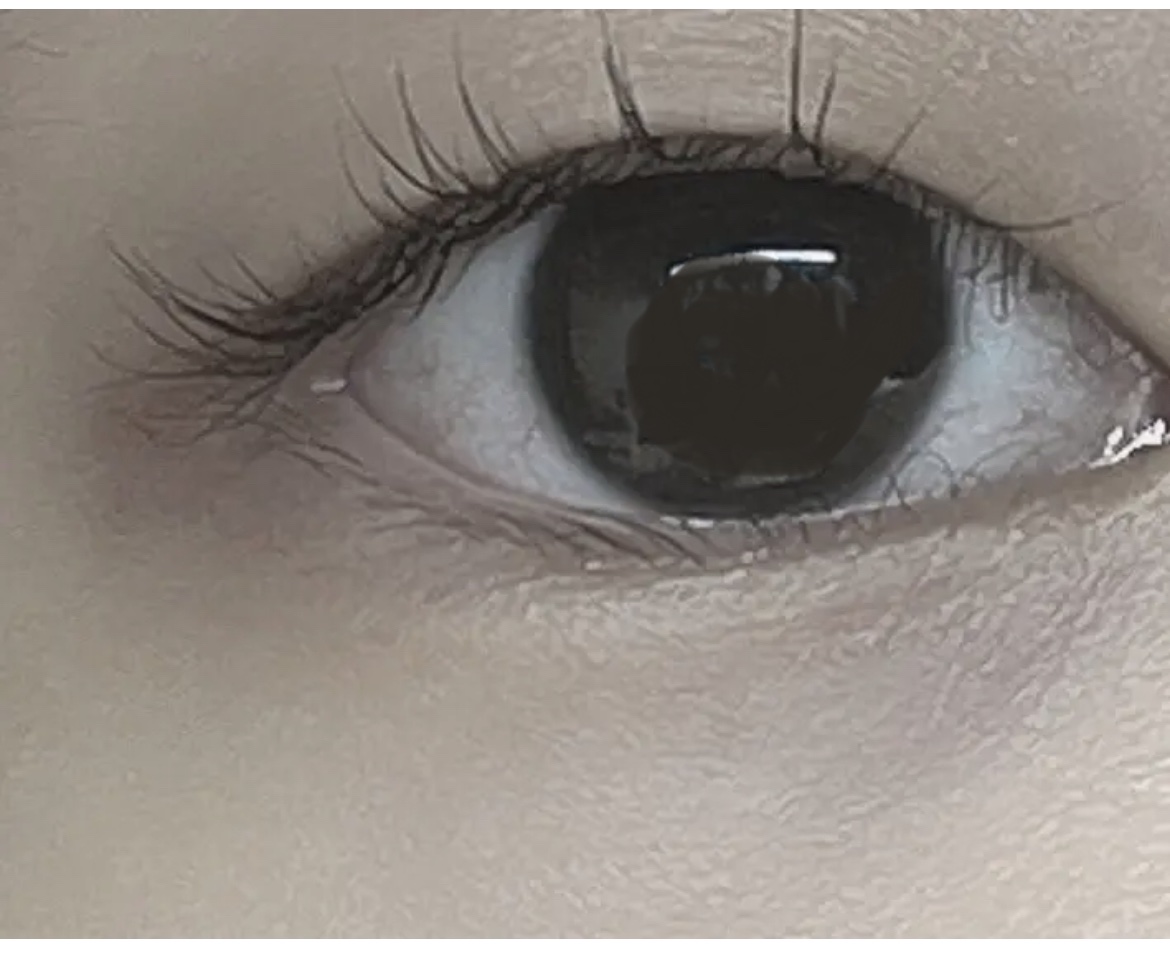 キュアティ ホワイト プレミアム(医薬品)/S SELECT/その他を使ったクチコミ（3枚目）