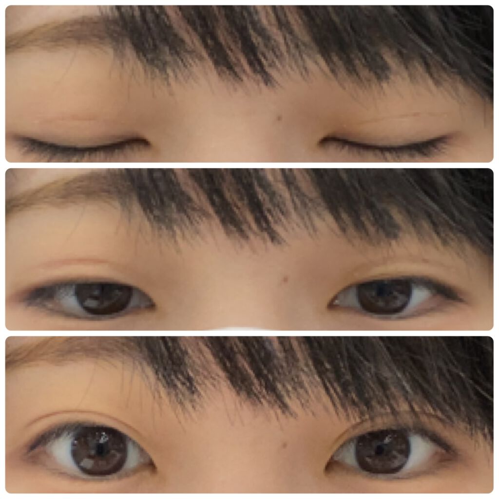 のびーるアイテープ（絆創膏タイプ、レギュラー）/DAISO/二重まぶた用アイテムを使ったクチコミ（3枚目）