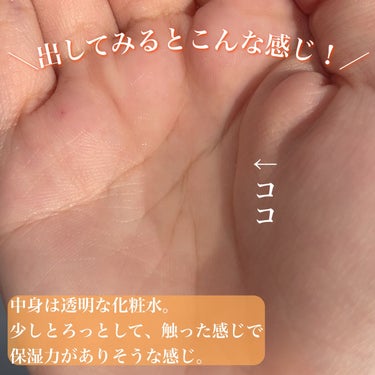 ドンキのセールって経営が心配になるくらい安くなるよね
【プラチナレーベル VC1000ローション】

✼••┈┈••✼••┈┈••✼••┈┈••✼••┈┈••✼

商品名：プラチナレーベル VC1000ローション

内容量：1000ml

香り：柑橘系の爽やかな香りがしたよ🤔

価格：セールで598円だった

✼••┈┈••✼••┈┈••✼••┈┈••✼••┈┈••✼

この前ドンキに行ったら在庫処分セールをしていたので、片っ端からスキンケア用品を見ていきました💪

そしたらこちらが598円という破格のお値段で販売されていたので即購入しました！

元のお値段が1000円超っていうのをさっき初めて知ったんですけど、やっぱドンキってすごい安いなぁ...🤔

こちらの化粧水はプラチナレーベルというブランドで、こちら以外だとハトムギ化粧水がドラッグストアとかで販売されてます✨

VC1000ローションはビタミンC誘導体が入っており、ハリのあるなめらかふっくら肌に導いてくれるそうです！

触ってみると少しとろみのあるテクスチャー！

香りは柑橘系でさっぱりしてます✨

私はいつもコットンに染み込ませたり、ダイソーの圧縮パックに染み込ませて使ったりしてます💕

これをほぼ毎日使っているのですが、たしかに肌がなめらかになってるのを実感しました😳

あと保湿力が結構あるので、もちっとした肌にもしてくれます🥺✨

正直パックの為に買ったのでどんな化粧水でもいいかなぁと思っていたのですが、めちゃくちゃ使い心地も良くて買ってよかったな...って思いました😭💕

でもこれ持って帰る時めっちゃ辛くて、肩脱臼するかと思いました🙃


#プラチナレーベル 
#ビタミンc 
#化粧水

の画像 その2