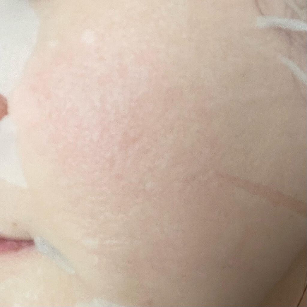 モイストリッチマスク/chione/シートマスク・パックを使ったクチコミ(6枚目)