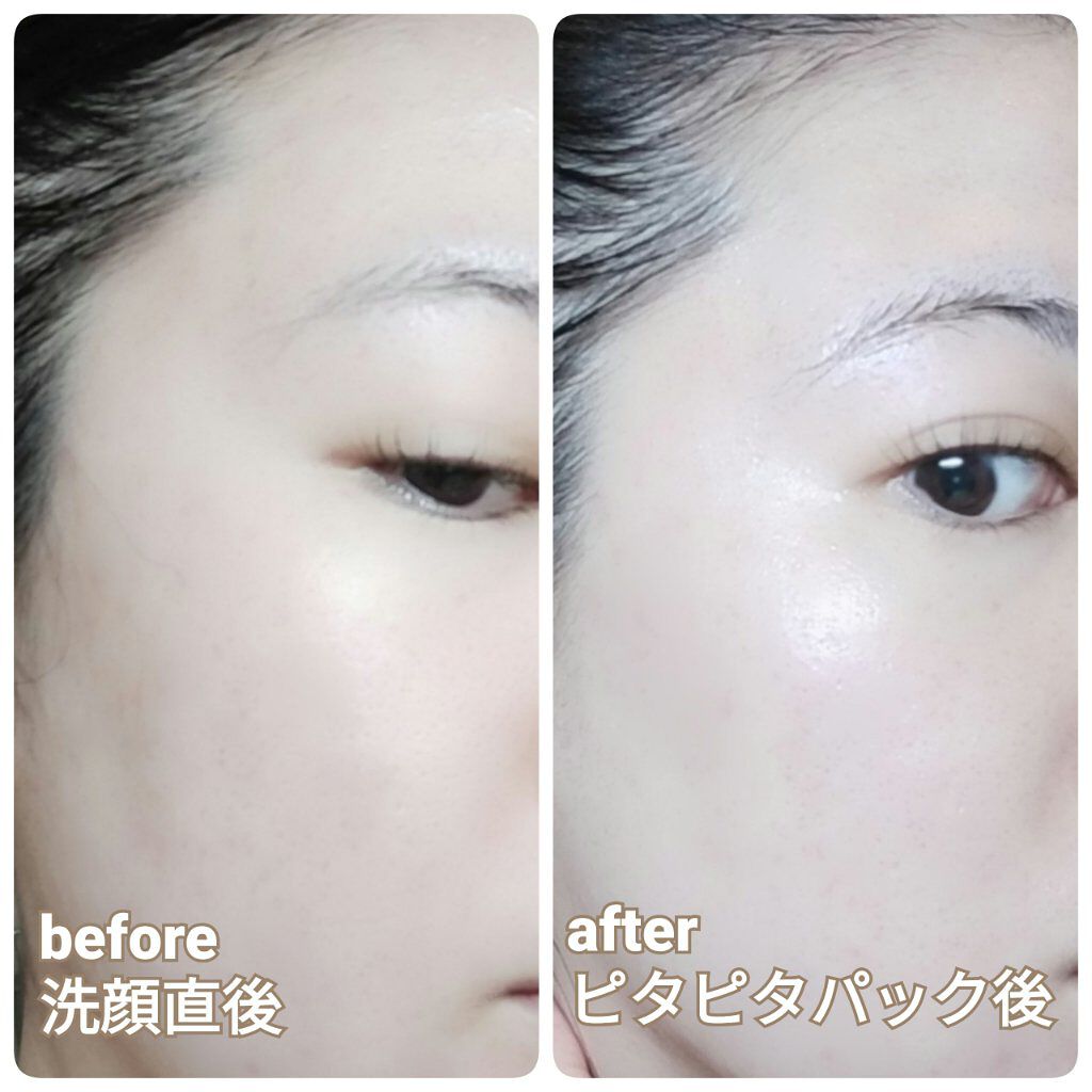 プロステージ VC100 ビタミンC モイスチャーローションリッチ/ナチュリア/化粧水を使ったクチコミ（2枚目）